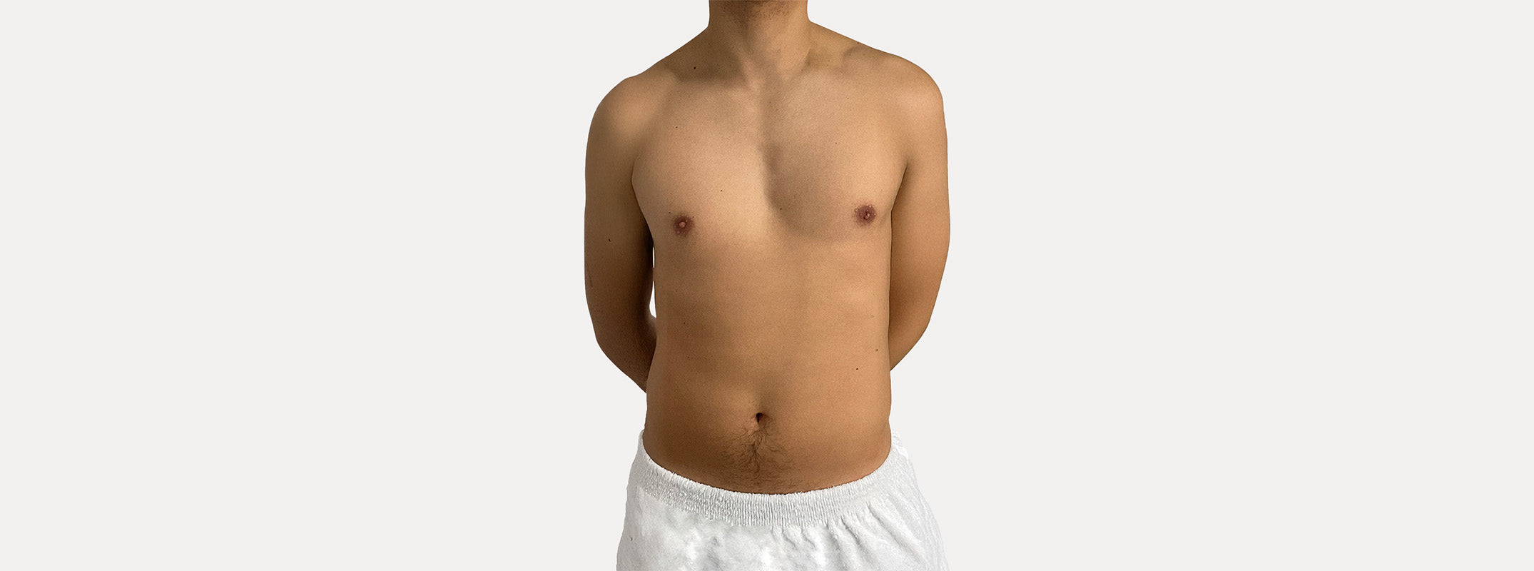 Torso de un hombre antes de pasar por el tratamiento de quick muscle.