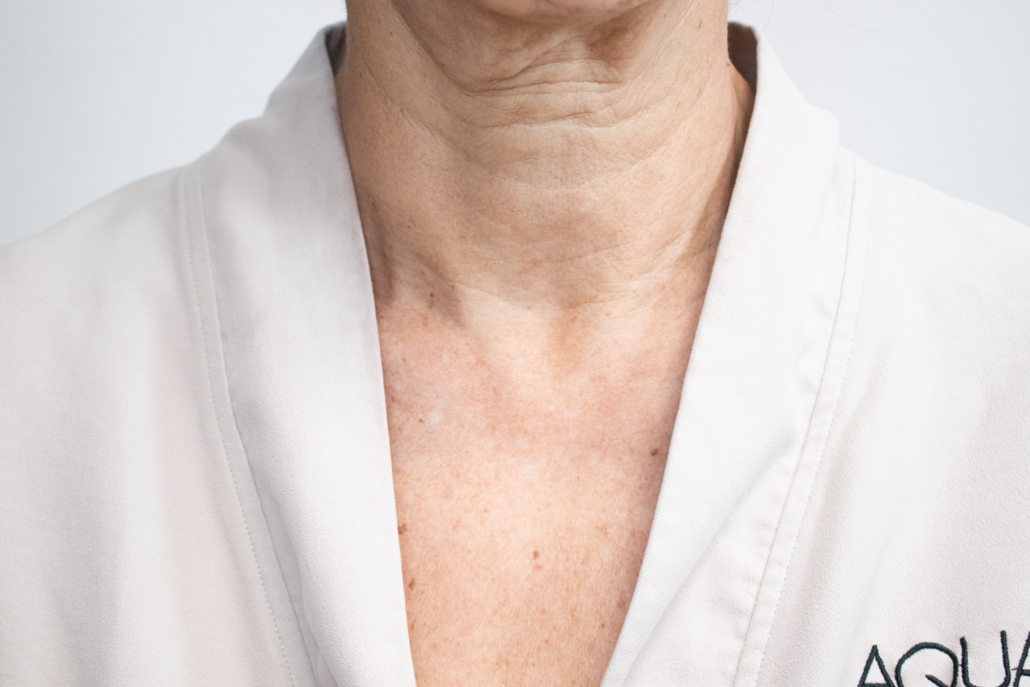 Evolift Láser CO2 Cuello o escote