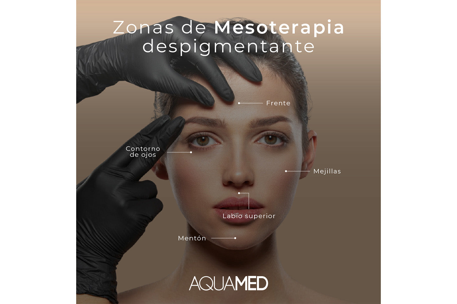 Infografía que muestra en que zonas se puede realizar Mesoterapia despigmentante: Frente, mejillas, contorno de ojos, labio superior y mentón.