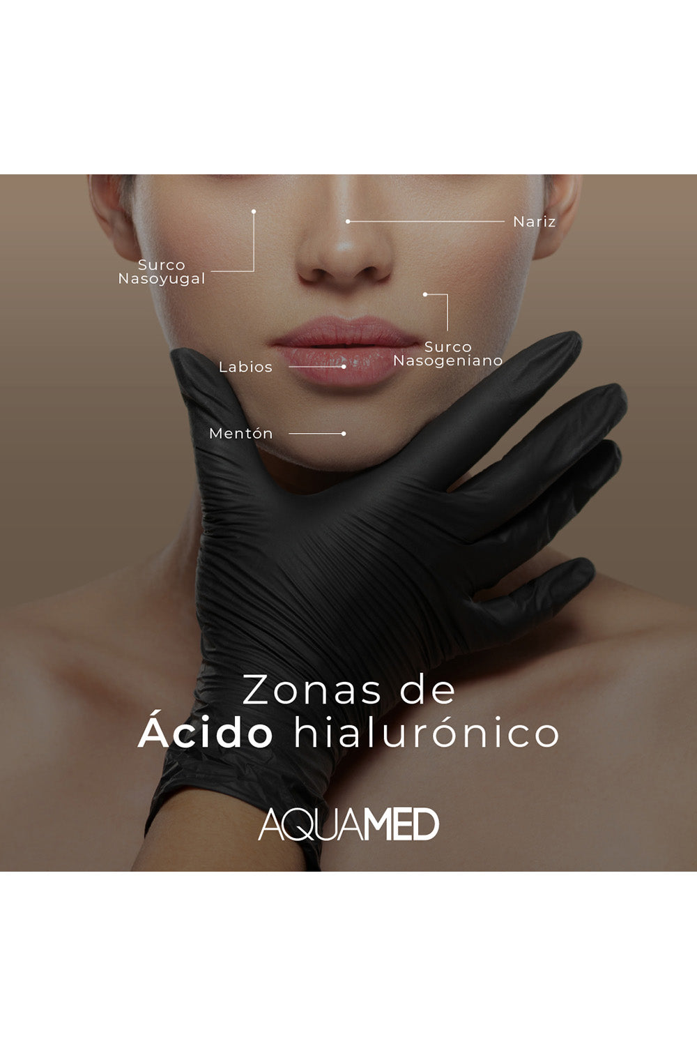 Infografía que muestra el rostro de una mujer y se señalan las "Zonas de Ácido Hialurónico", las cuales son: Surco Nasogeniano, Nariz, Surco Nasoyugal, Labios y Mentón.