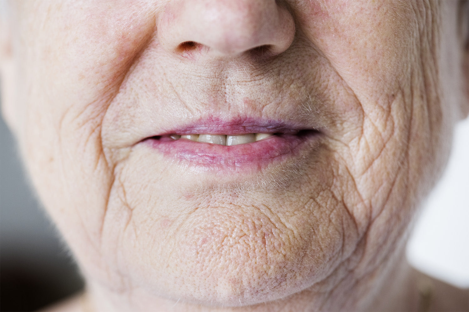 Acercamiento de la parte inferior del rostro de una mujer con arrugas.