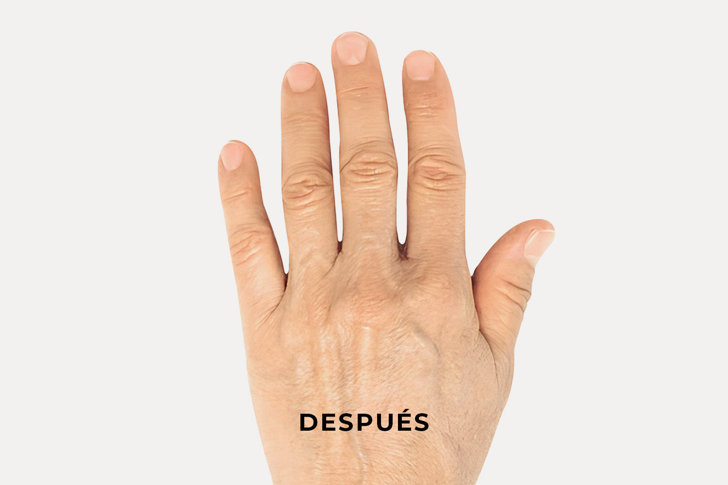 Acercamiento de una mano sin léntigos solares que tiene la palabra "Después" sobre la imagen.