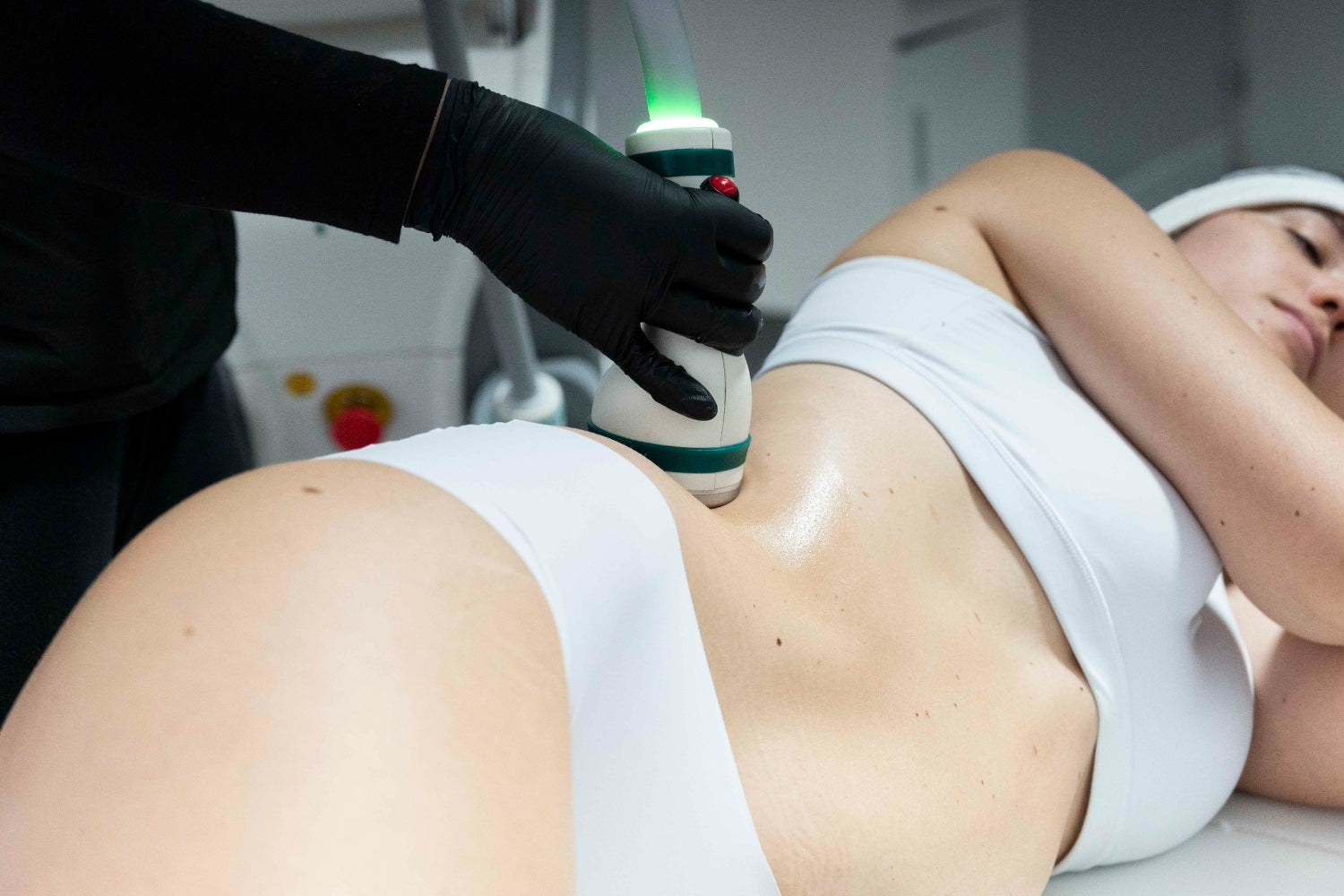 Mujer recibiendo un tratamiento cosmético en el estómago.