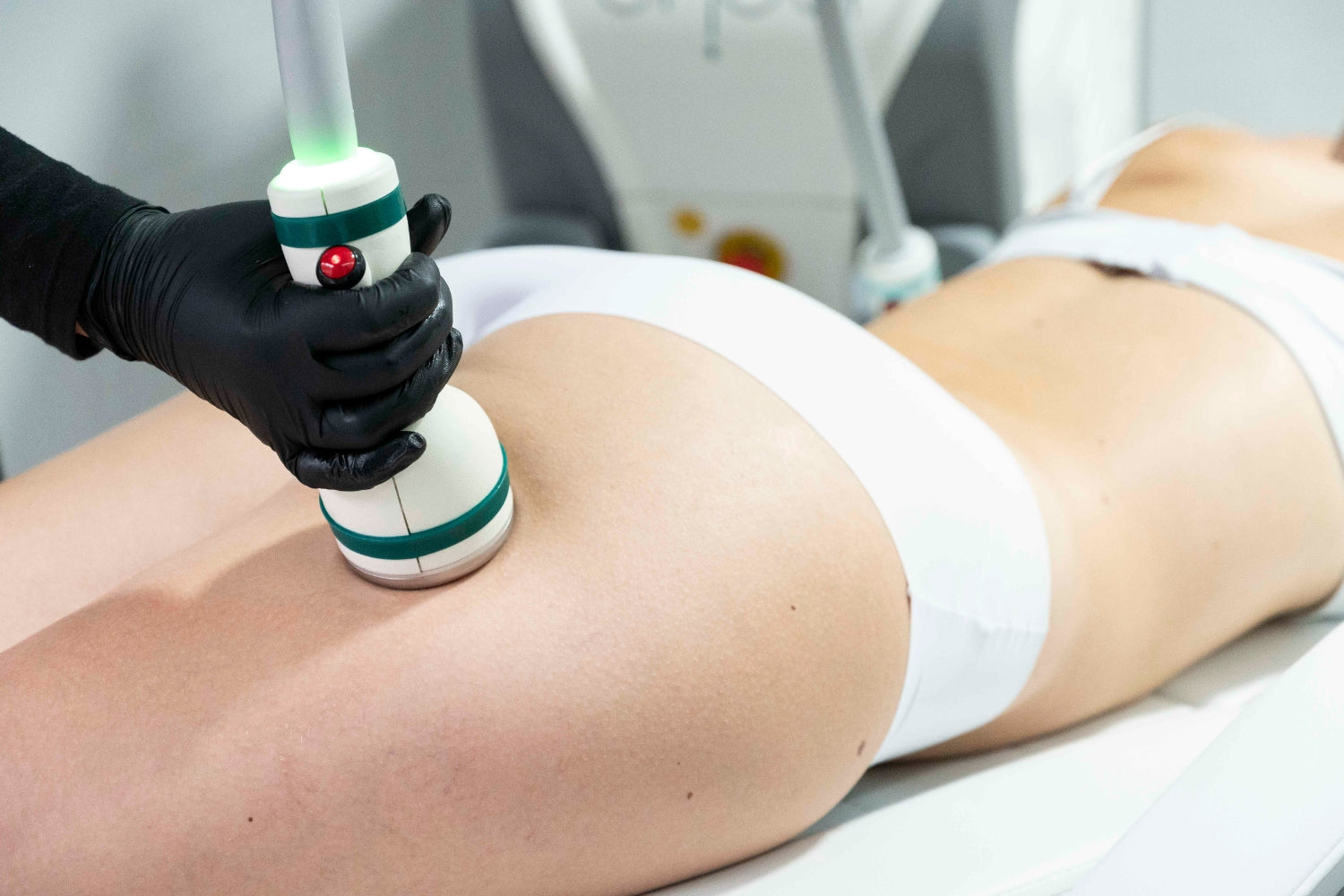 Mujer recibiendo un tratamiento cosmético en el muslo.