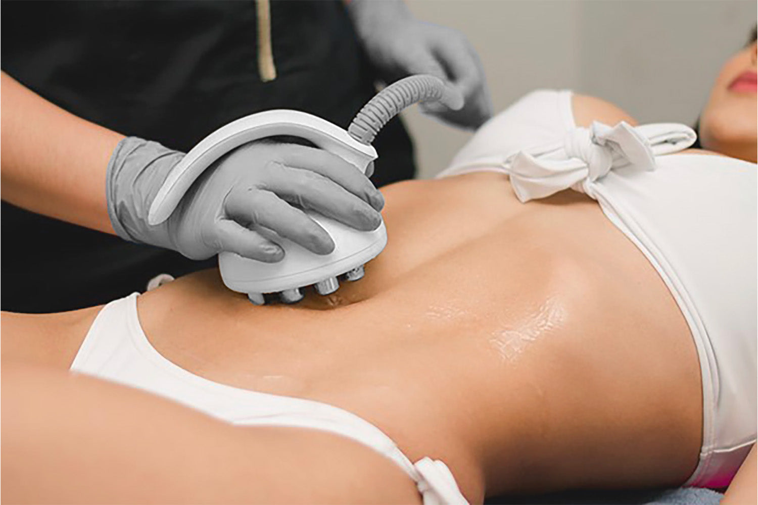 Mujer recibiendo un tratamiento cosmético en el abdomen.