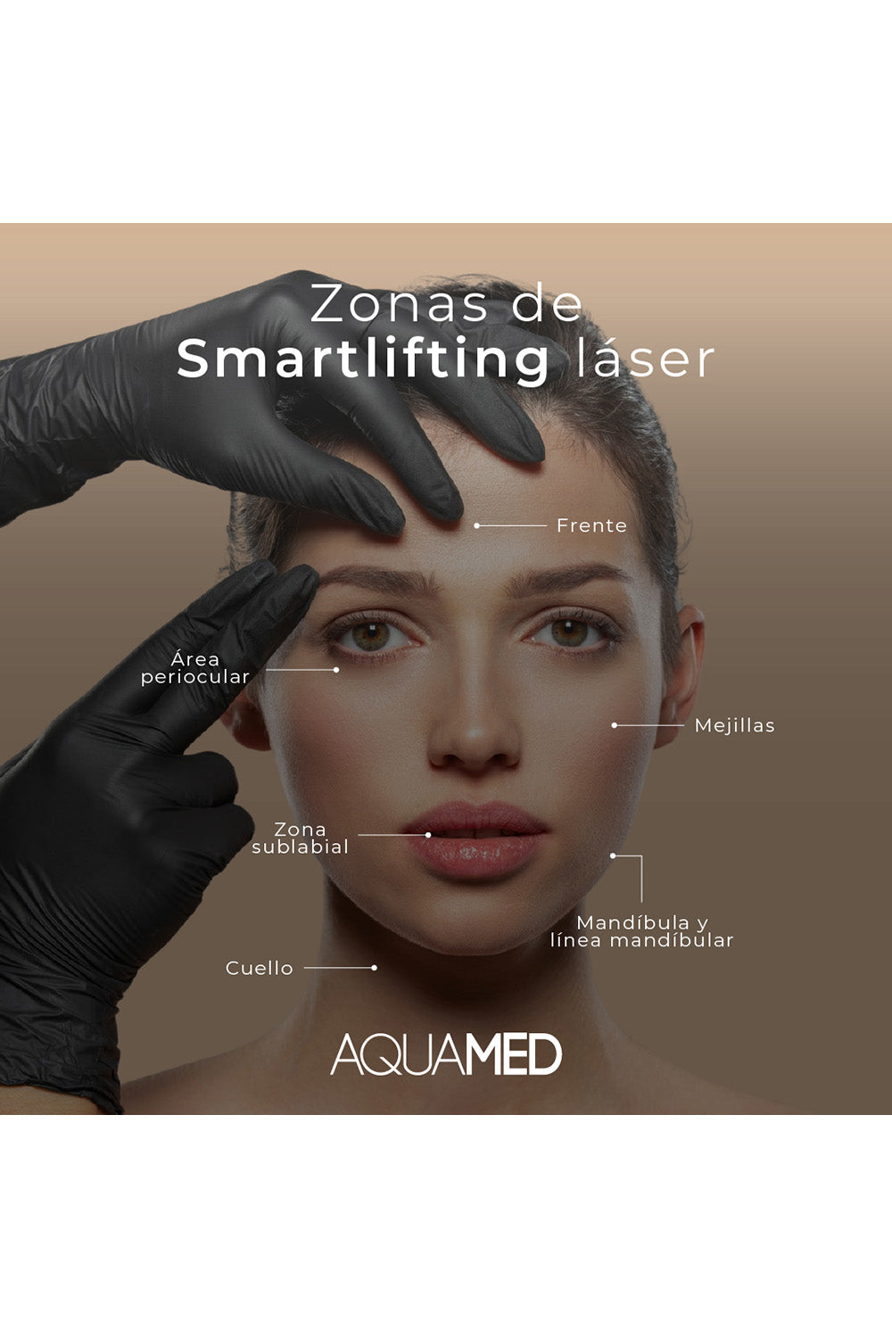 Imagen de un rostro con información escrita encima que señala las zonas dónde se realiza el smartlifting láser: frente, área periocular, mejillas, zona sublabial, mandíbula y línea mandibular, cuello. 