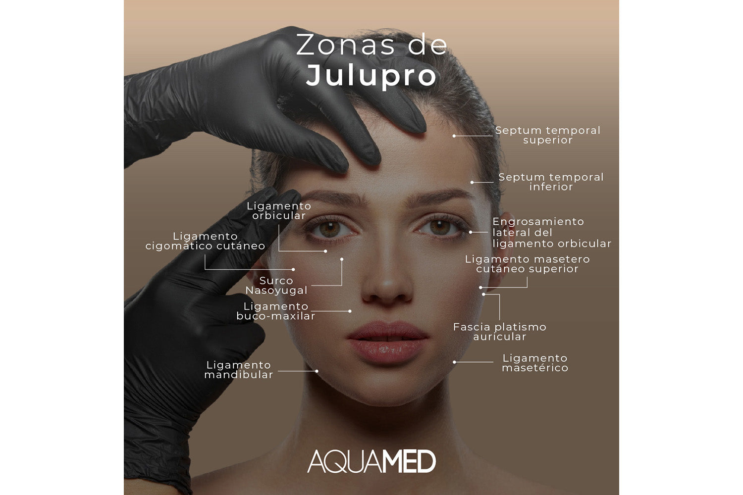 Infografía que muestras las zonas dónde se puede aplicar Julupro: Septum temporal superior, Septum temporal inferior, Engrosamiento lateral del ligamento orbicular, Ligamento masetero cutáneo superior, Fascia Platismo auricular, Ligamento masetérico, Ligamento mandibular, Ligamento buco-maxilar, Surco nasoyugal, Ligamento cigomático-cutáneo y Ligamento orbicular. 