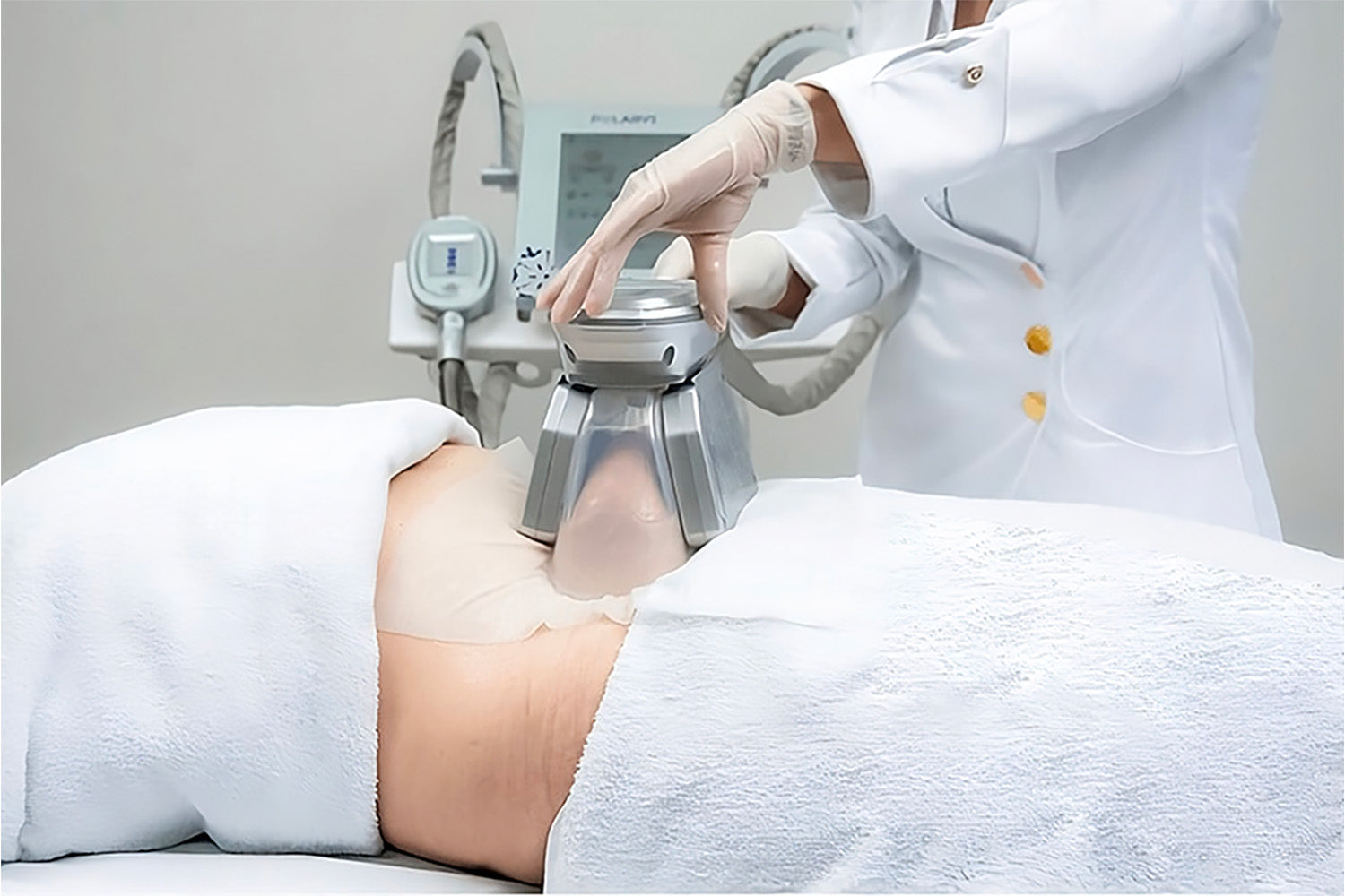 Persona recibiendo un tratamiento cosmético en el abdomen.