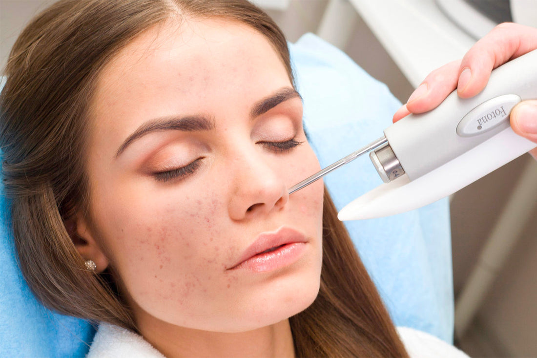 Mujer recibiendo un tratamiento cosmético de láser en el rostro.