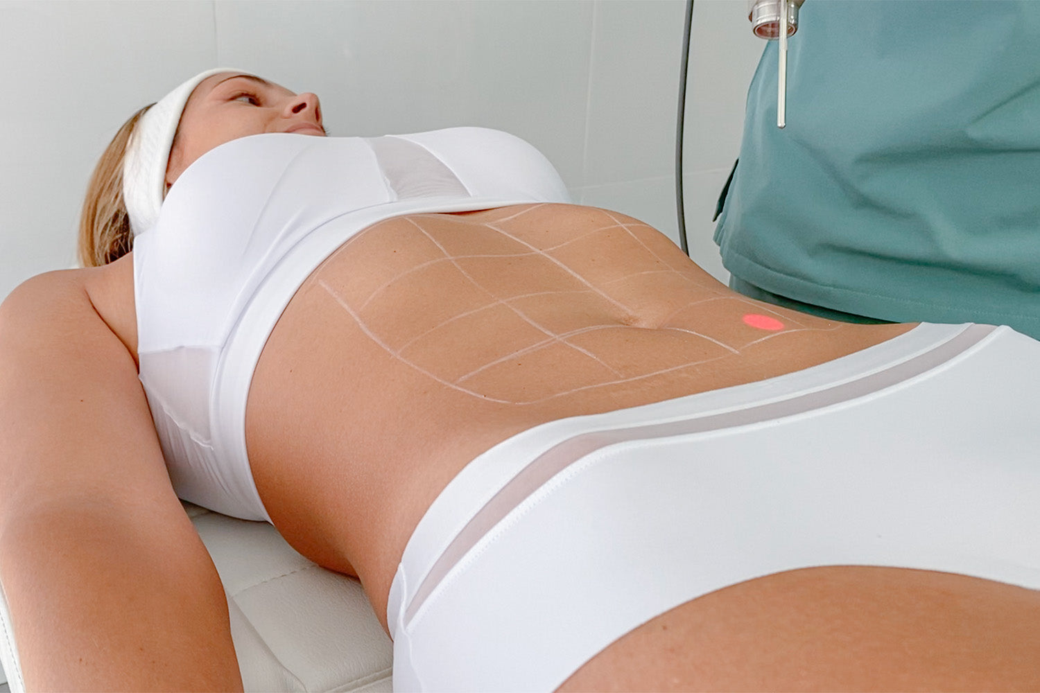 Mujer recibiendo tratamiento láser en su abdomen.