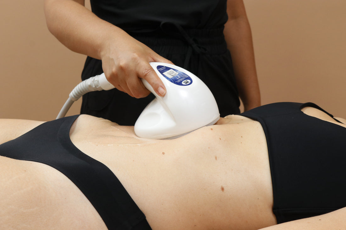 Mujer recibiendo un tratamiento cosmético en el abdomen.