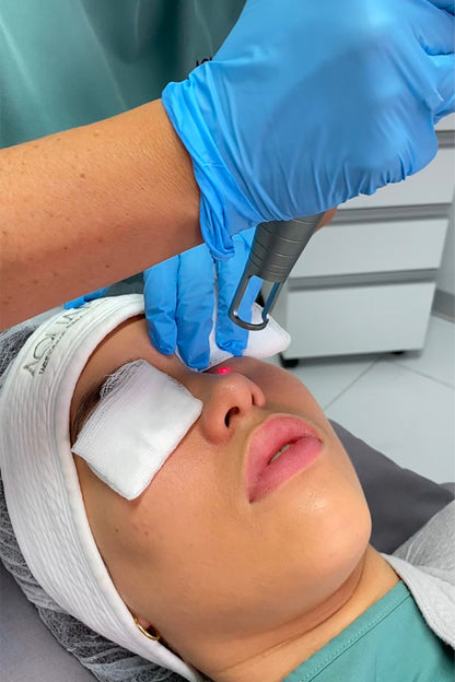 Mujer recibiendo un tratamiento cosmético en el rostro.