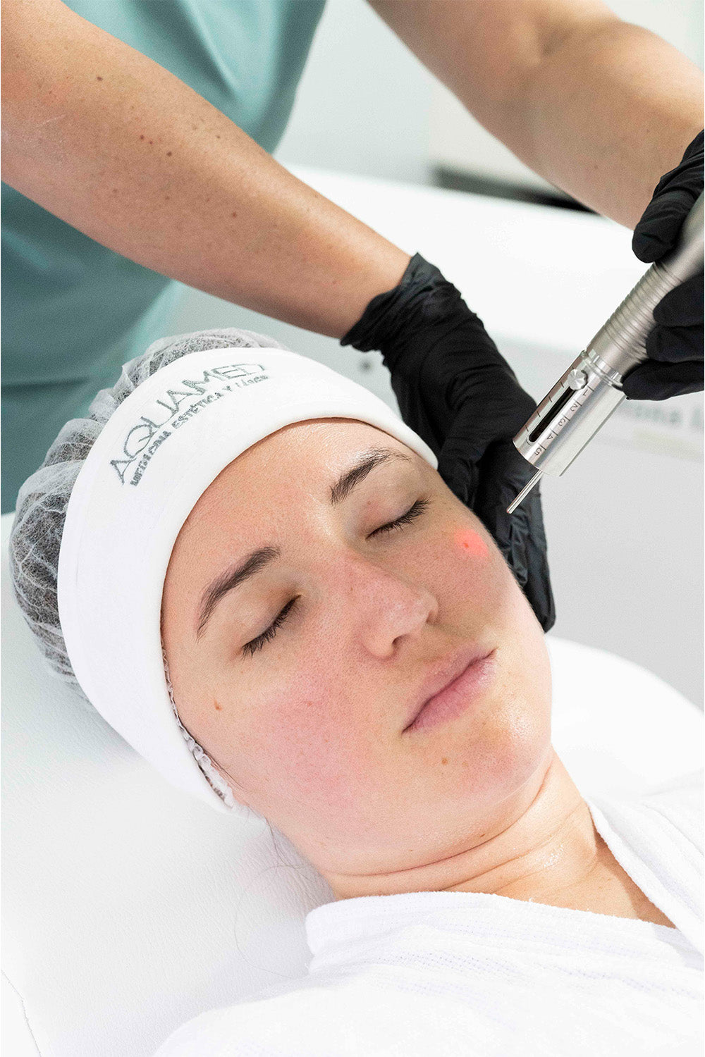 Mujer recibiendo tratamiento láser en su rostro.