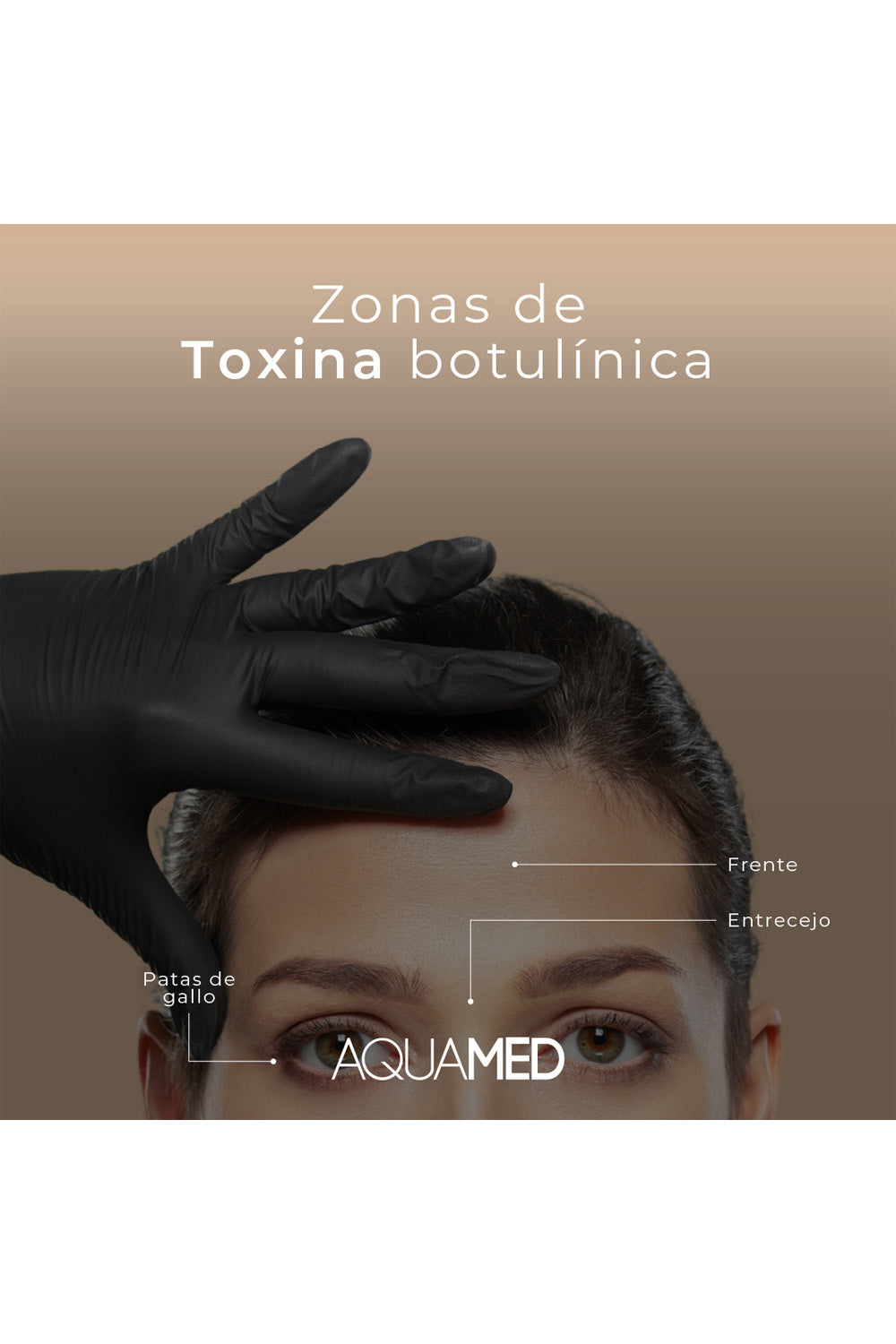 Infografía que muestra el rostro de una mujer y se señalan las &quot;Zonas de Toxina botulínica&quot;, las cuales son: frente, patas de gallo y entrecejo.